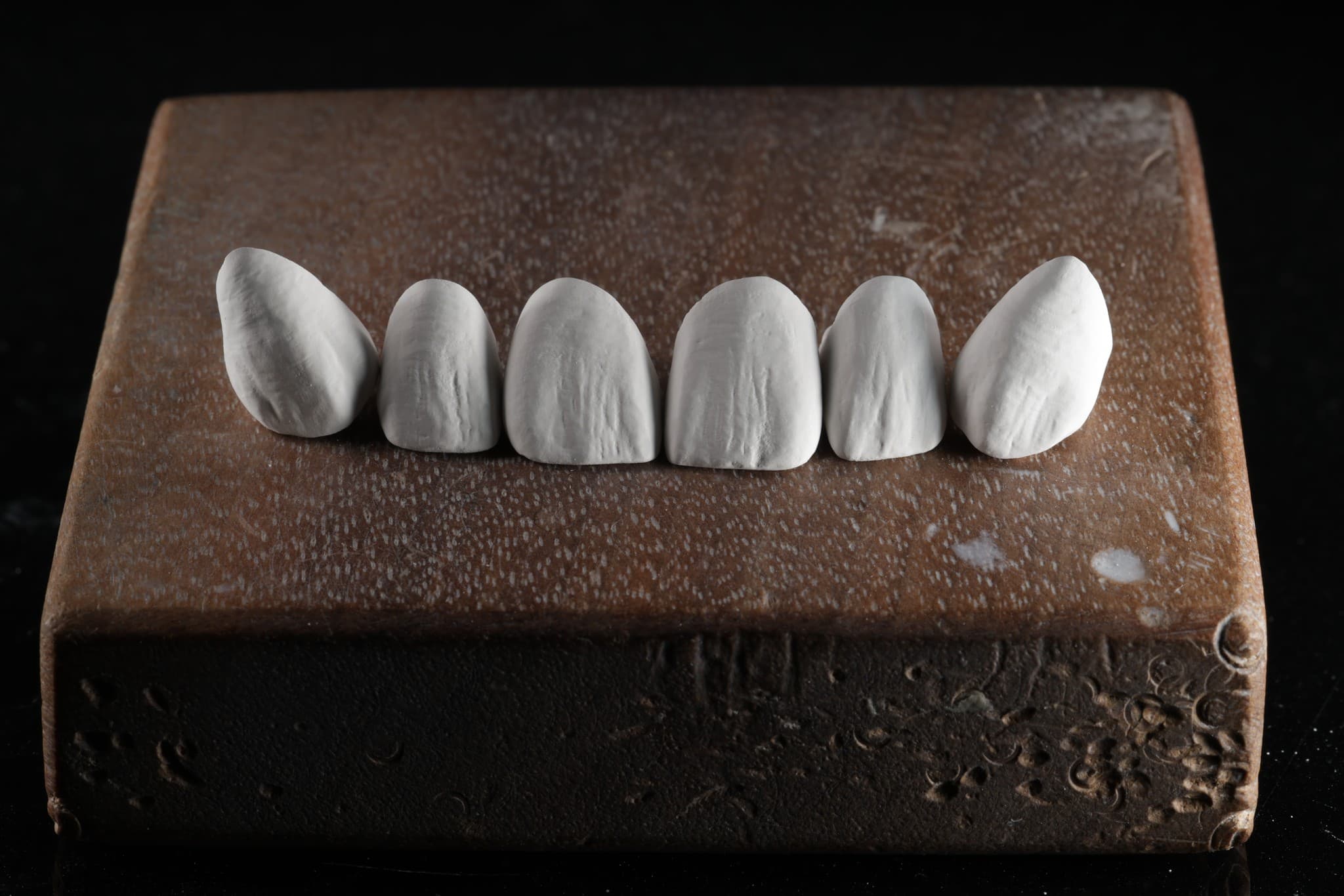 Vonley Crowns — fase di lavorazione
