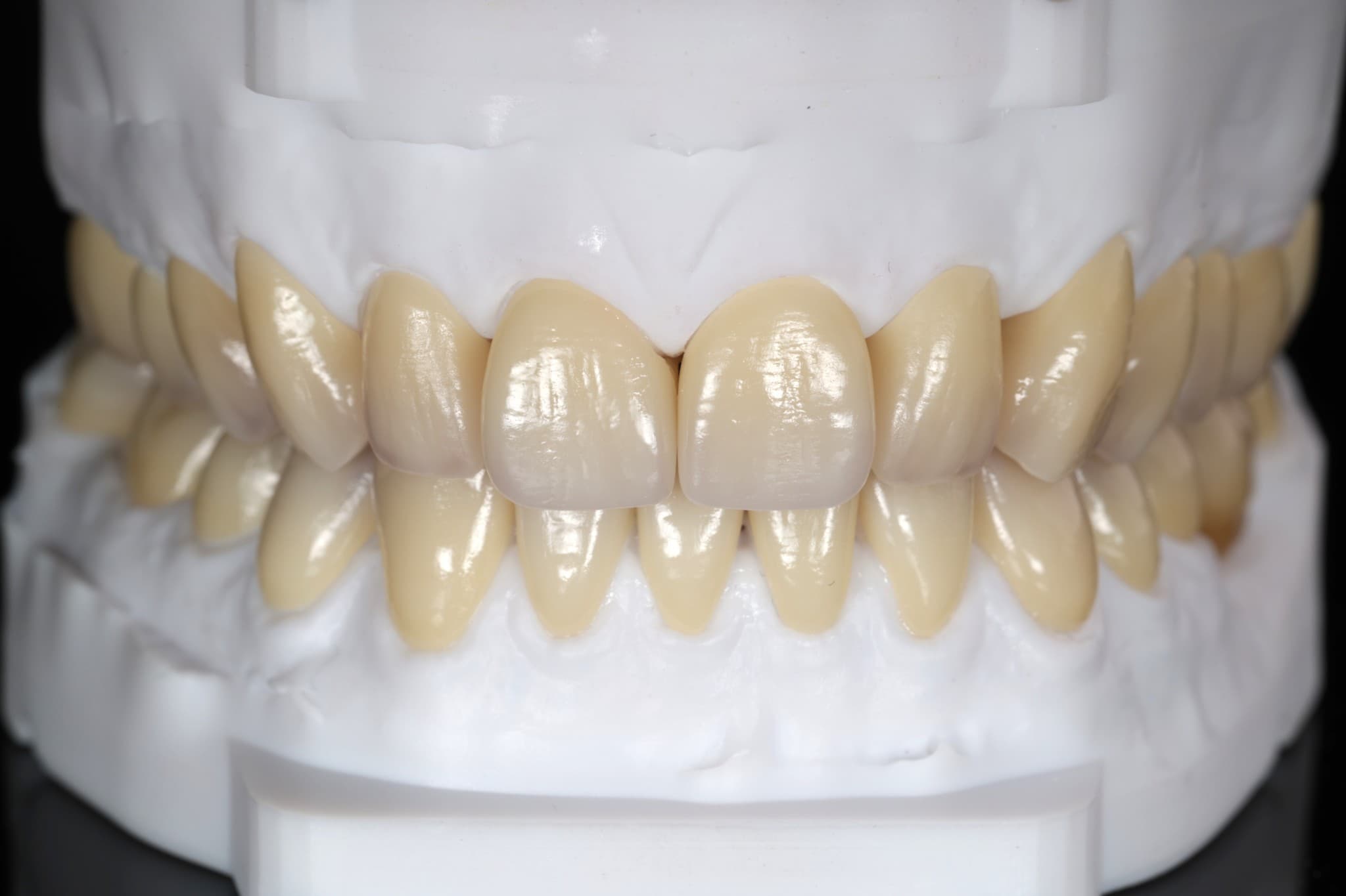 Vonley Crowns — fase di lavorazione