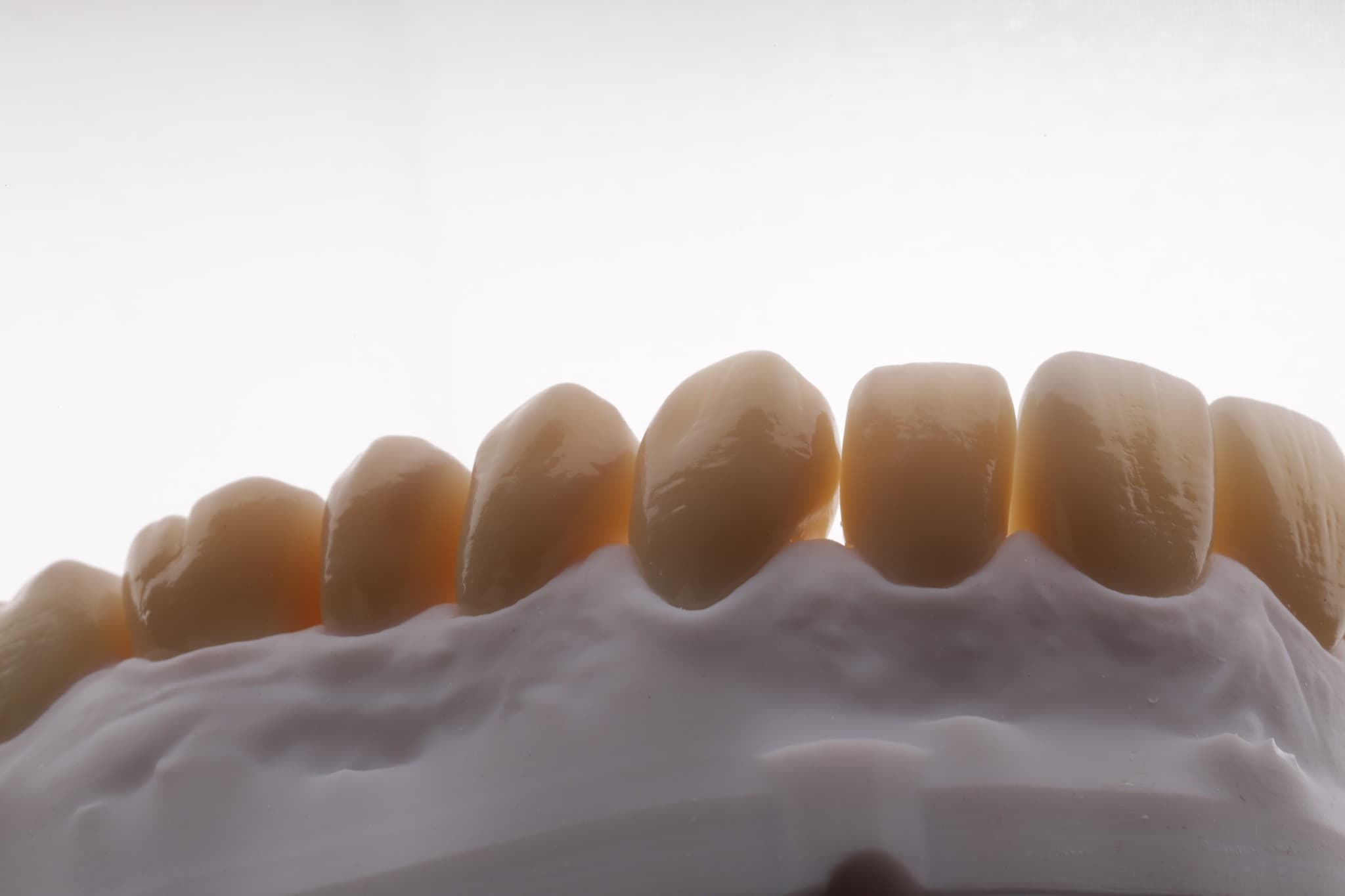 Vonley Crowns — fase di rifinitura