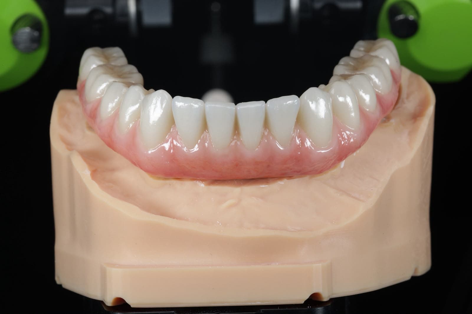 Zirconia su Zirconia — dettaglio della caratterizzazione ceramica
